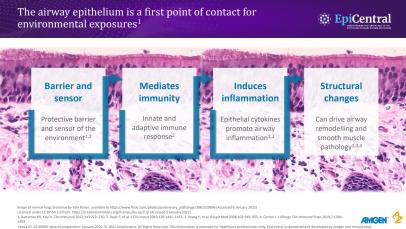 Role Of The Epithelium In Asthma | AZ EpiCentral Global